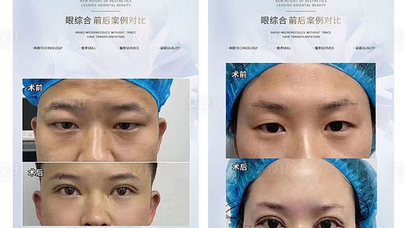 开场白：自信与专业的展现