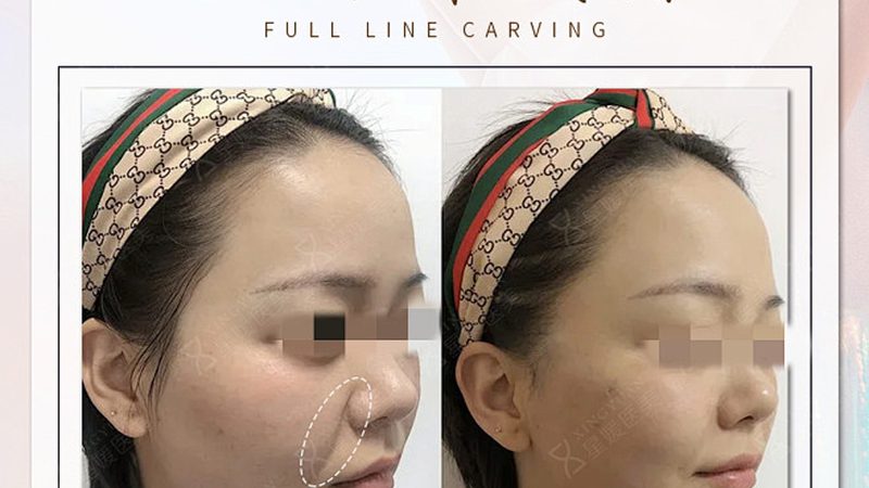 对于学生来说，由于皮肤状态较好，适合的项目主要包括：
