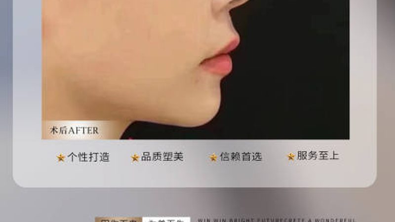 医美咨询师工作流程揭秘：专业服务背后的细节