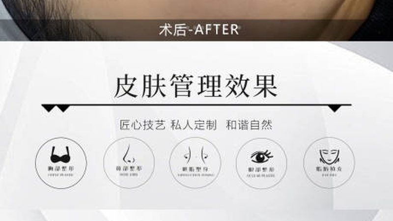 沈阳韩式双眼皮，适合哪些人群？**