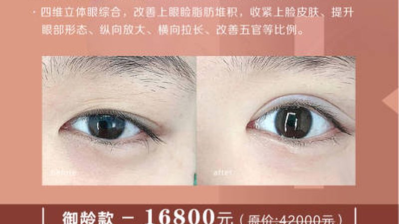 医美咨询师咨询步骤：揭秘专业咨询的奥秘
