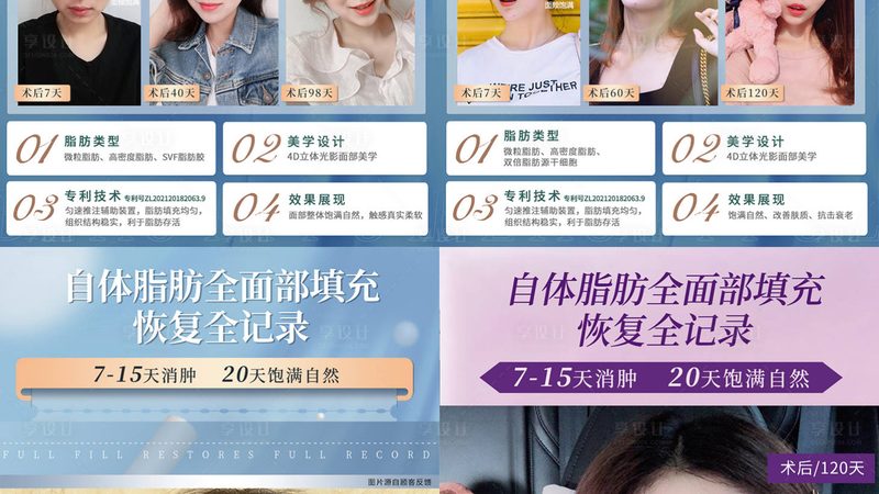 自体脂肪填充禁忌人群