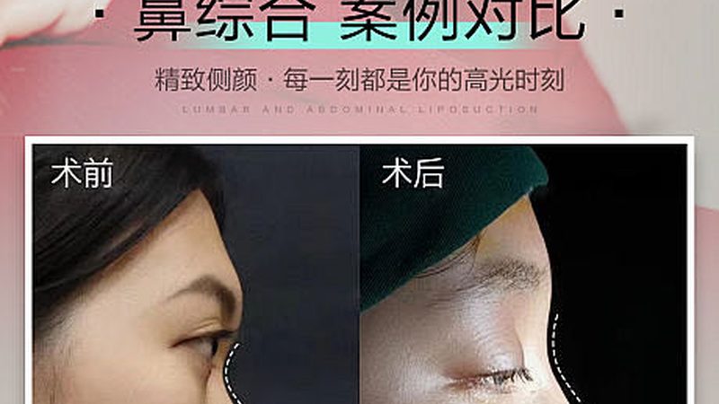 光子嫩肤：揭秘其原理与如何选择优质机构