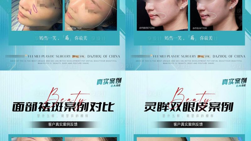 原厂配件真假混用，热玛吉效果打折的根源在哪