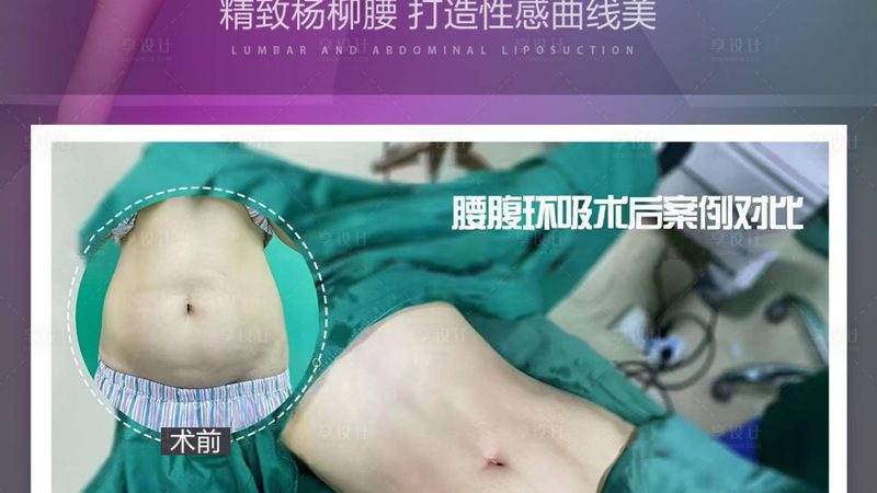 光子嫩肤与激光美容，价格差异背后的秘密