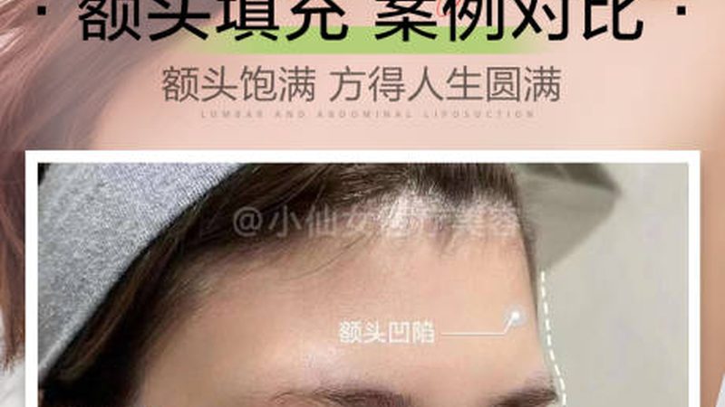 超声炮操作手法大揭秘：不同手法背后的技术差异